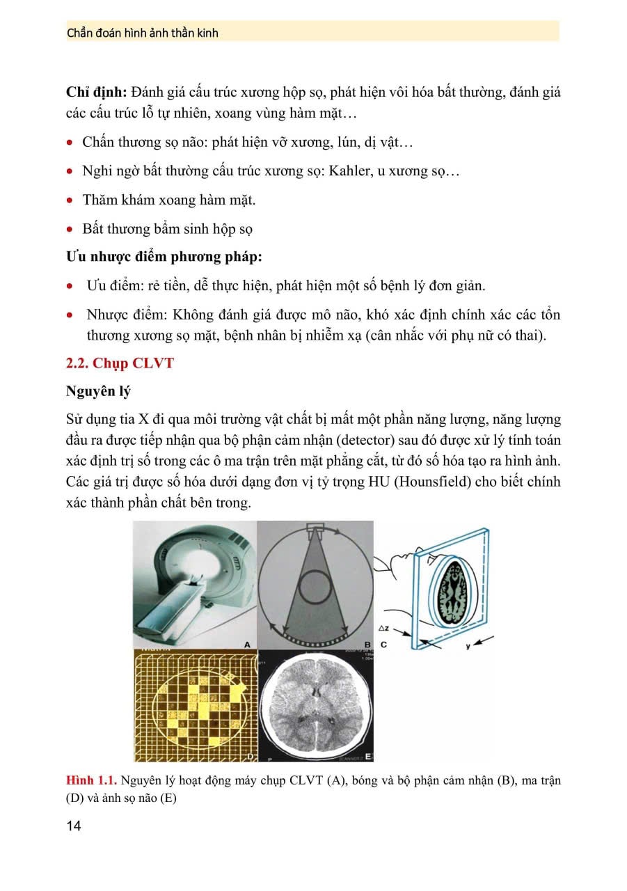 Chẩn Đoán Hình Ảnh Thần Kinh ( Giáo Trình Sau Đại Học ) - PGS.TS Vũ Đăng Lưu