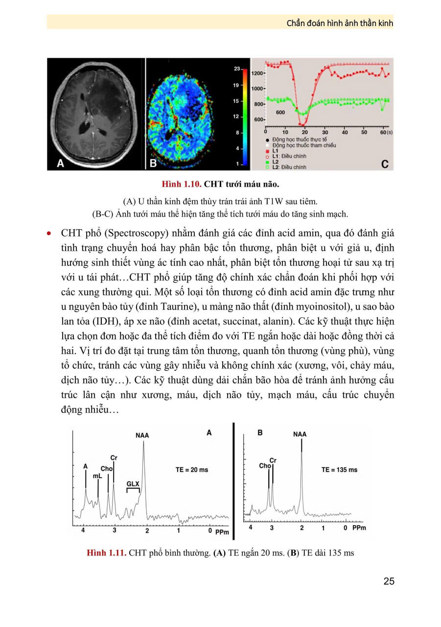 Chẩn Đoán Hình Ảnh Thần Kinh ( Giáo Trình Sau Đại Học ) - PGS.TS Vũ Đăng Lưu