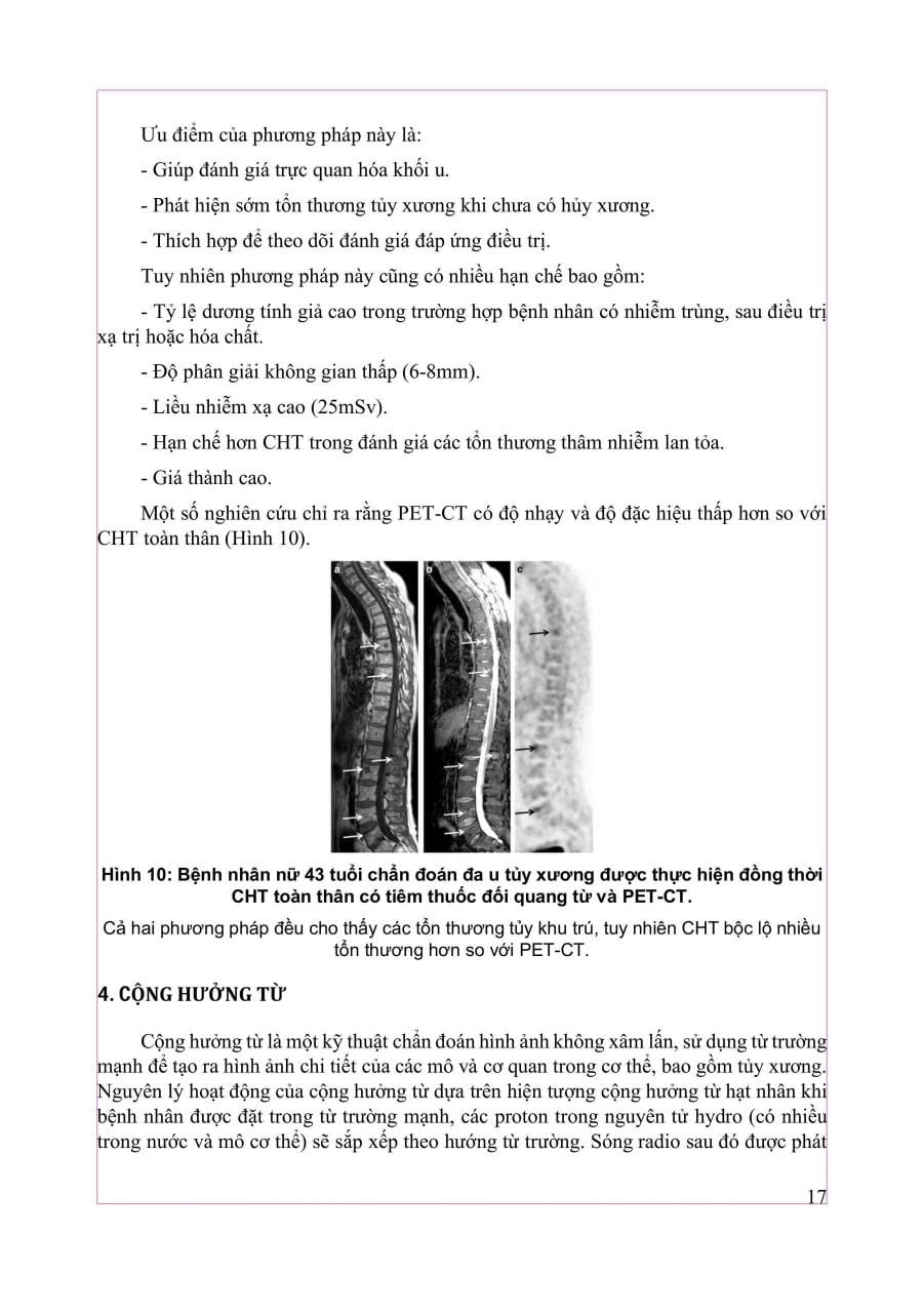 Chẩn Đoán Hình Ảnh Cơ Xương Khớp Tập 2 - PGS.TS.BS Nguyễn Duy Hùng