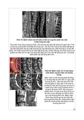 Chẩn Đoán Hình Ảnh Cơ Xương Khớp Tập 2 - PGS.TS.BS Nguyễn Duy Hùng