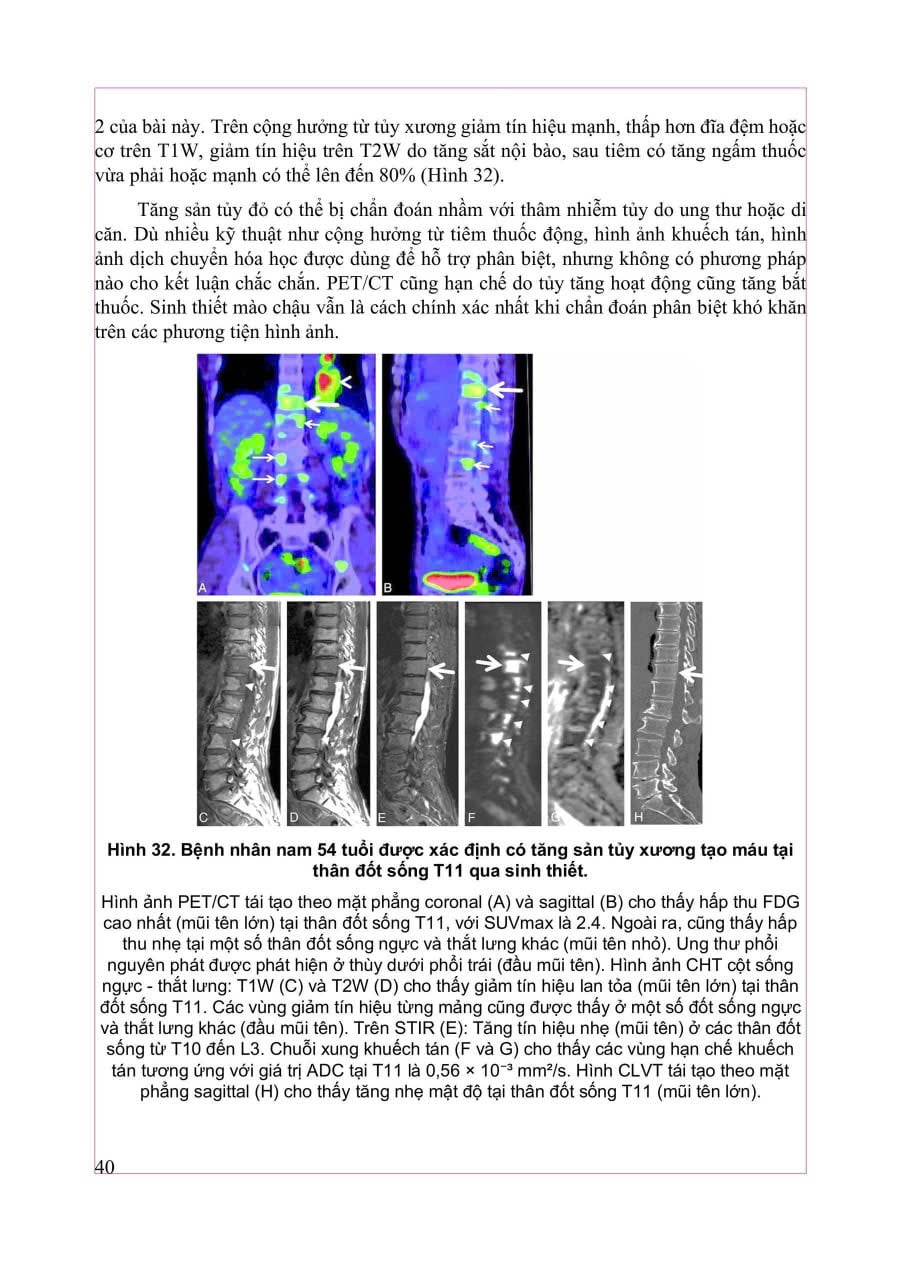 Chẩn Đoán Hình Ảnh Cơ Xương Khớp Tập 2 - PGS.TS.BS Nguyễn Duy Hùng
