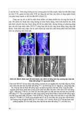 Chẩn Đoán Hình Ảnh Cơ Xương Khớp Tập 2 - PGS.TS.BS Nguyễn Duy Hùng