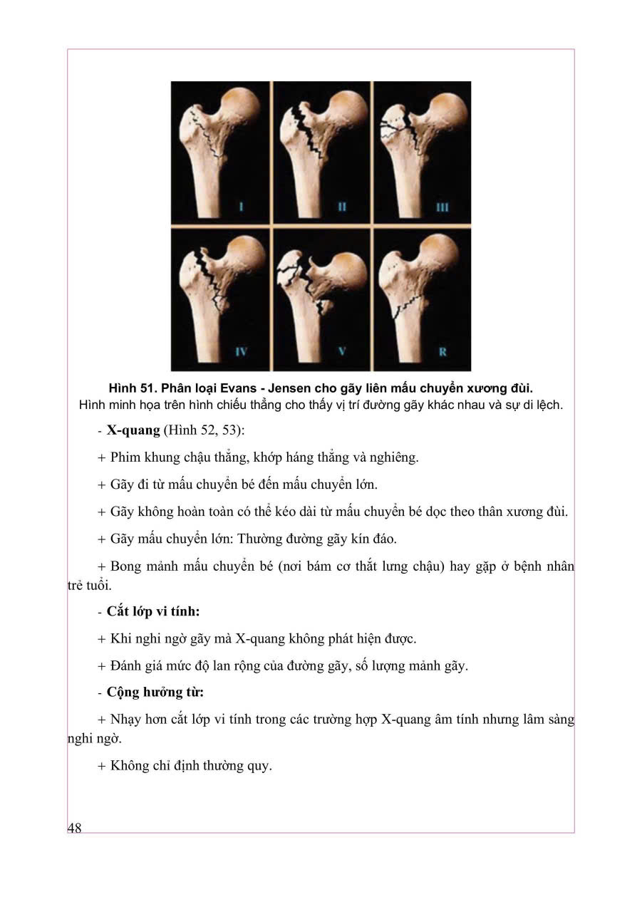 Chẩn Đoán Hình Ảnh Cơ Xương Khớp Tập 1 - PGS.TS.BS Nguyễn Duy Hùng