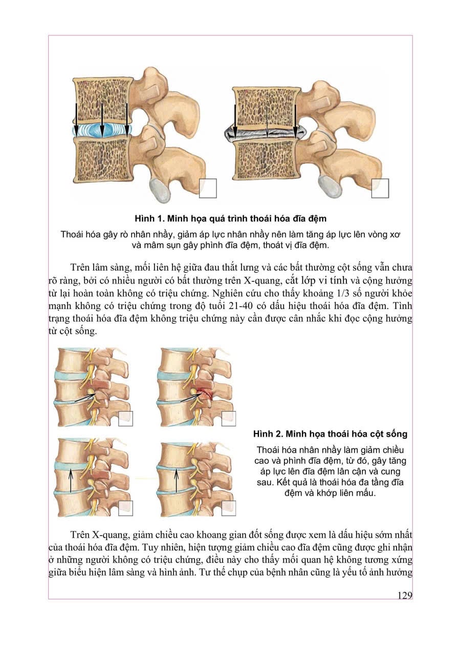 Chẩn Đoán Hình Ảnh Cơ Xương Khớp Tập 1 - PGS.TS.BS Nguyễn Duy Hùng
