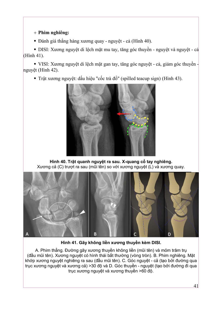Chẩn Đoán Hình Ảnh Cơ Xương Khớp Tập 1 - PGS.TS.BS Nguyễn Duy Hùng