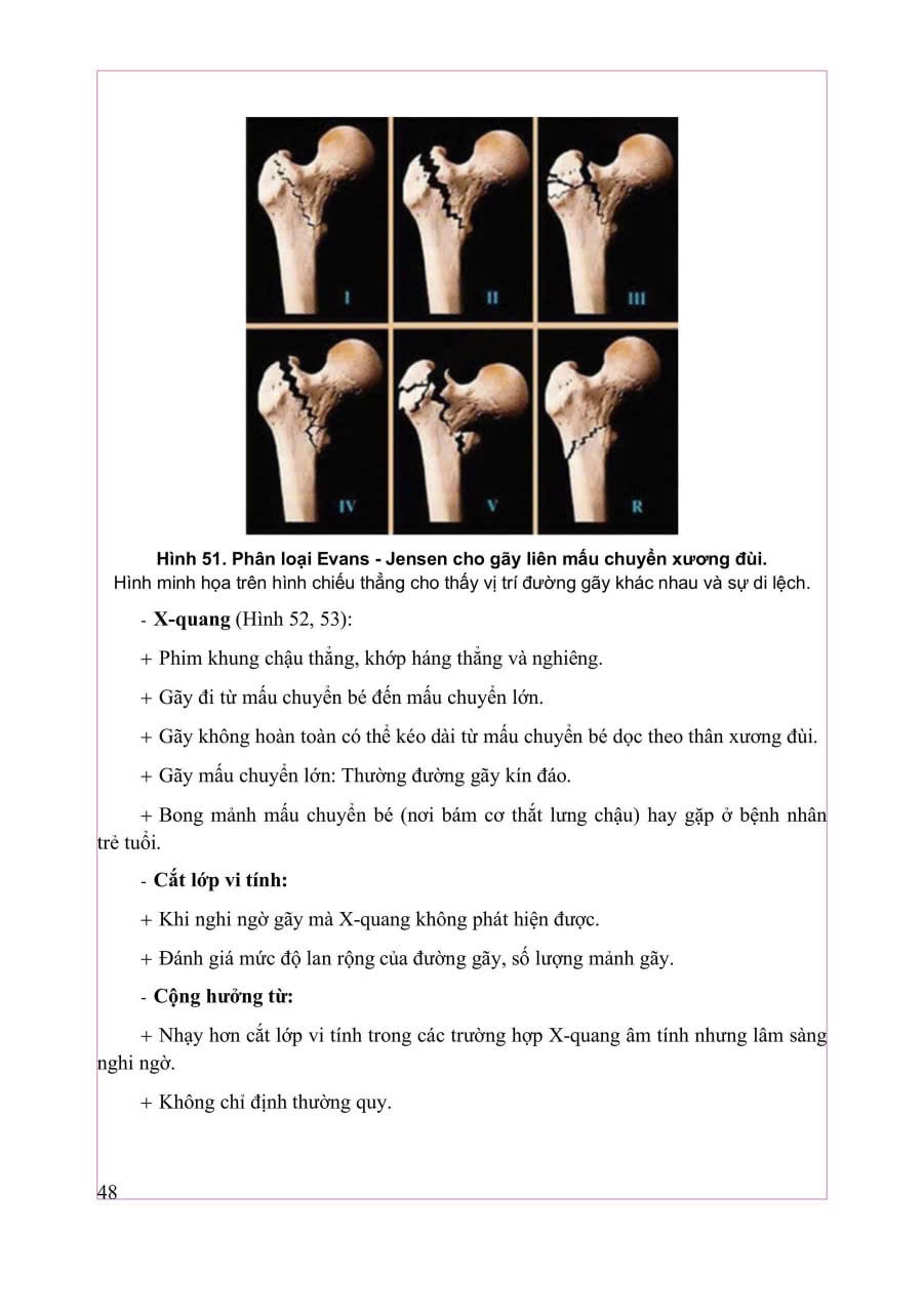 Chẩn Đoán Hình Ảnh Cơ Xương Khớp Tập 1 - PGS.TS.BS Nguyễn Duy Hùng