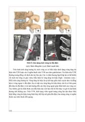 Chẩn Đoán Hình Ảnh Cơ Xương Khớp Tập 1 - PGS.TS.BS Nguyễn Duy Hùng