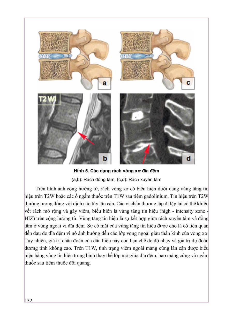 Combo 2 Cuốn Chẩn Đoán Hình Ảnh Cơ Xương Khớp ( Tập 1 + 2 ) - PGS.TS.BS Nguyễn Duy Hùng
