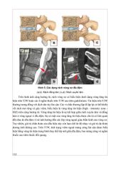 Combo 2 Cuốn Chẩn Đoán Hình Ảnh Cơ Xương Khớp ( Tập 1 + 2 ) - PGS.TS.BS Nguyễn Duy Hùng