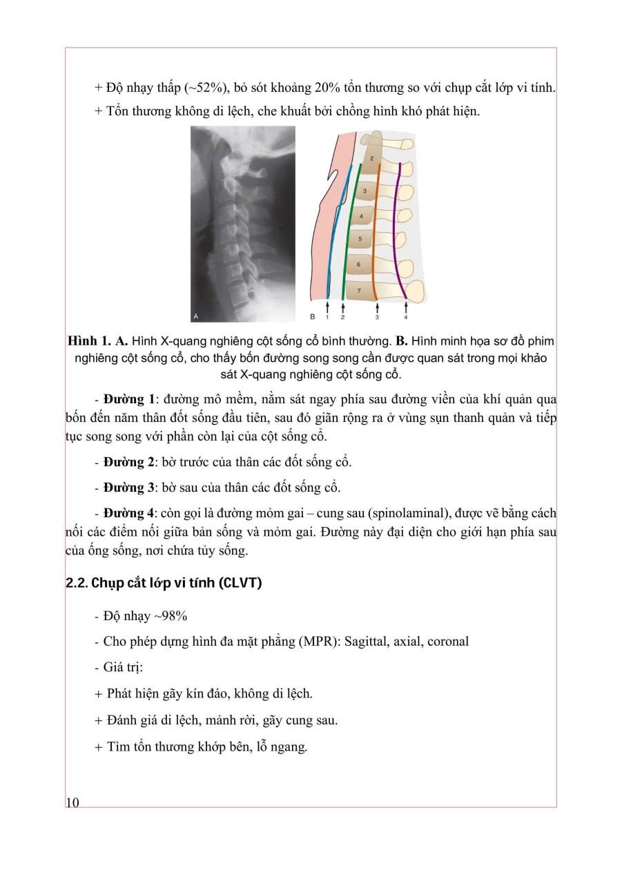 Chẩn Đoán Hình Ảnh Cơ Xương Khớp Tập 1 - PGS.TS.BS Nguyễn Duy Hùng