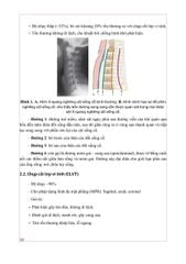 Chẩn Đoán Hình Ảnh Cơ Xương Khớp Tập 1 - PGS.TS.BS Nguyễn Duy Hùng
