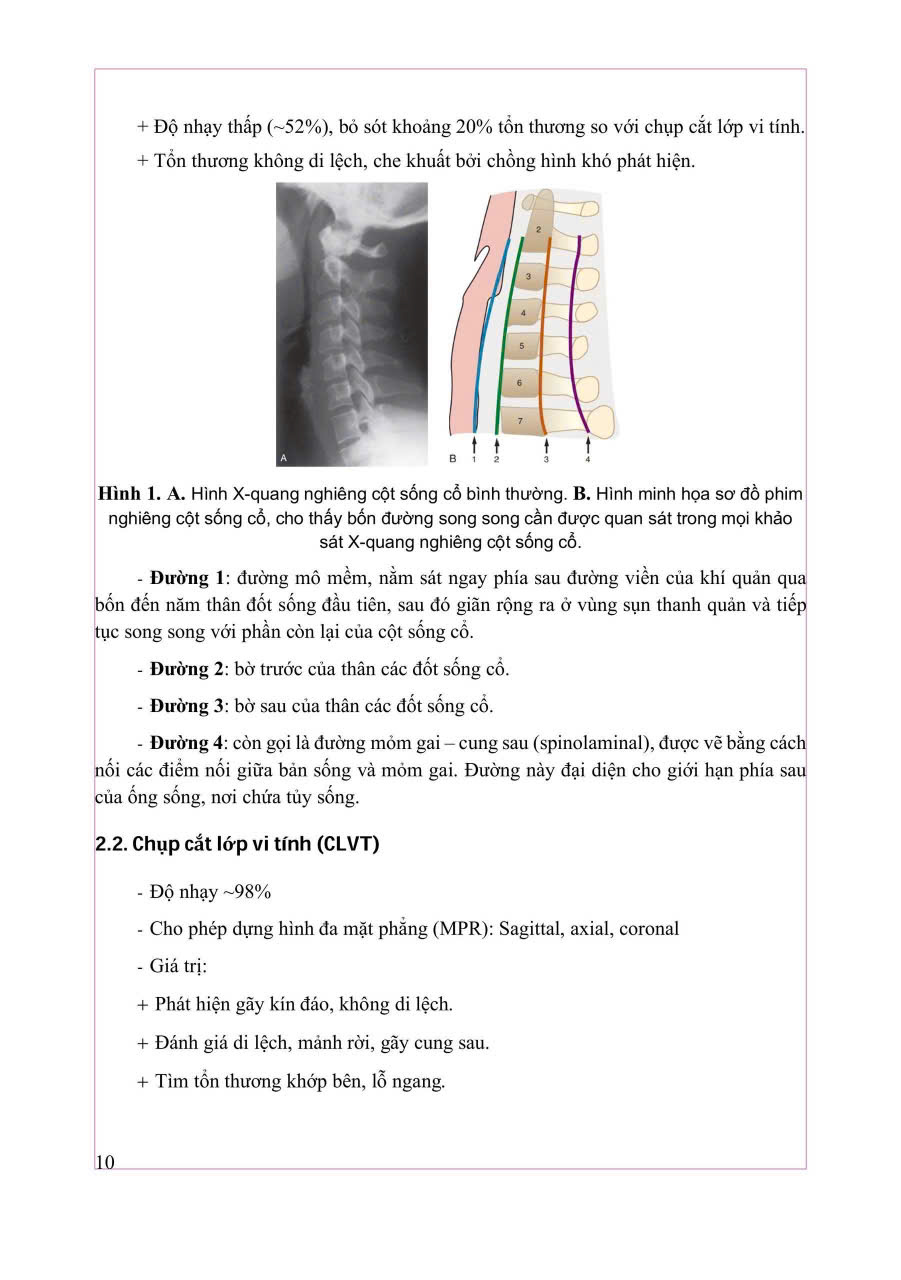 Combo 2 Cuốn Chẩn Đoán Hình Ảnh Cơ Xương Khớp ( Tập 1 + 2 ) - PGS.TS.BS Nguyễn Duy Hùng