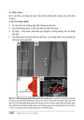 Điện Quang Can Thiệp ( Giáo Trình Sau Đại Học ) - PGS. TS. Vũ Đăng Lưu