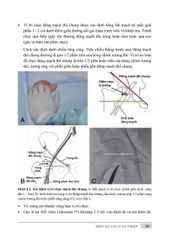 Điện Quang Can Thiệp ( Giáo Trình Sau Đại Học ) - PGS. TS. Vũ Đăng Lưu