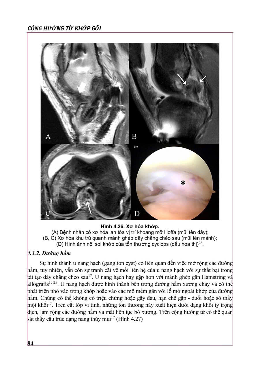 Cộng Hưởng Từ Khớp Gối - PGS.TS.BS Nguyễn Huy Hùng