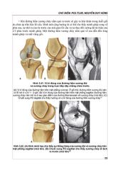 Cộng Hưởng Từ Khớp Gối - PGS.TS.BS Nguyễn Huy Hùng