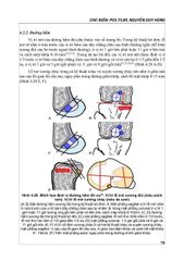Cộng Hưởng Từ Khớp Gối - PGS.TS.BS Nguyễn Huy Hùng