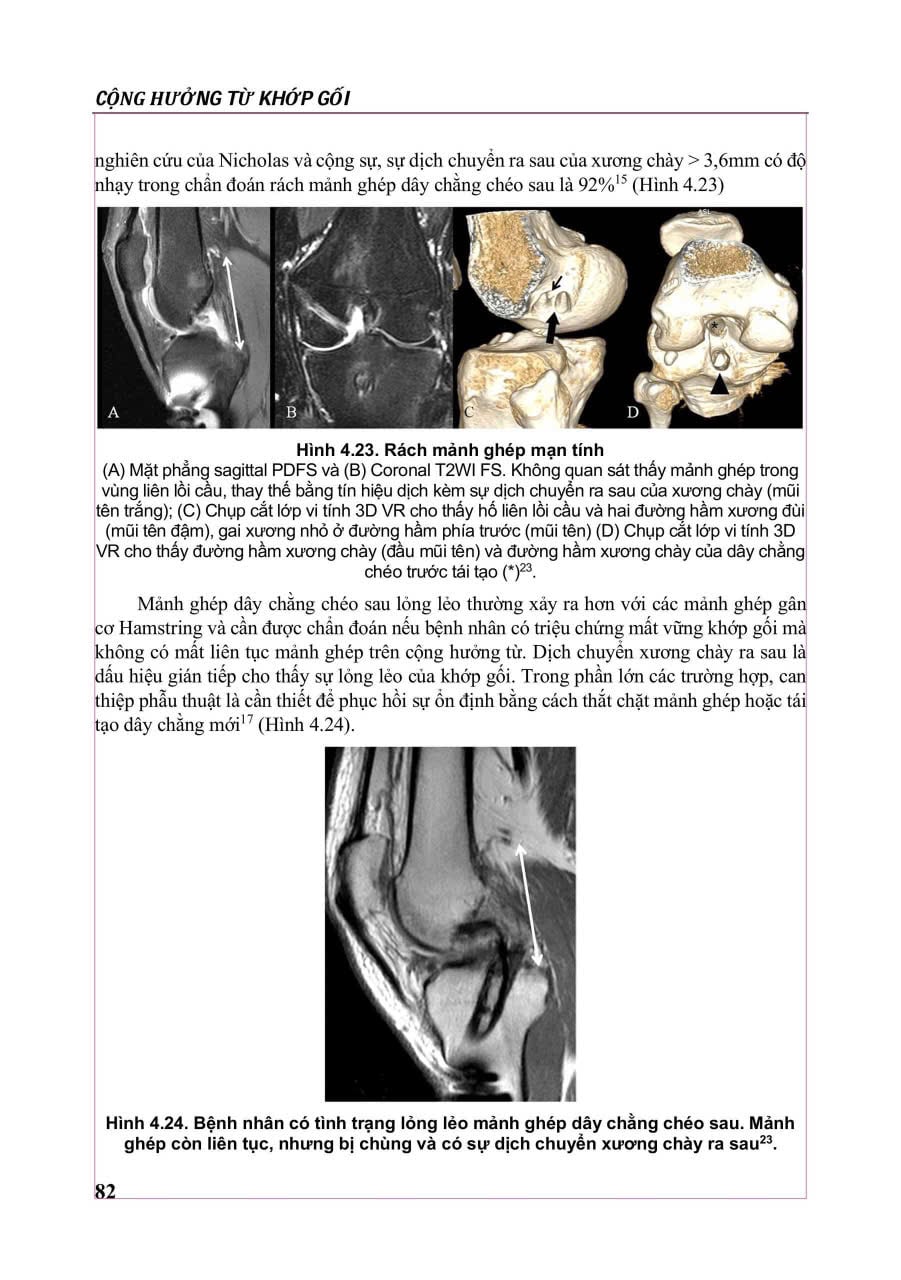 Cộng Hưởng Từ Khớp Gối - PGS.TS.BS Nguyễn Huy Hùng