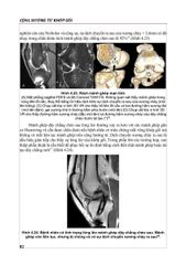 Cộng Hưởng Từ Khớp Gối - PGS.TS.BS Nguyễn Huy Hùng
