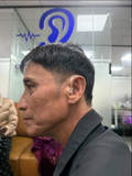  Máy trợ thính Acosound L4-BTE-P 