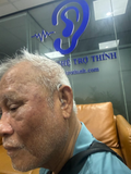  Máy trợ thính Acosound L4-BTE-P 