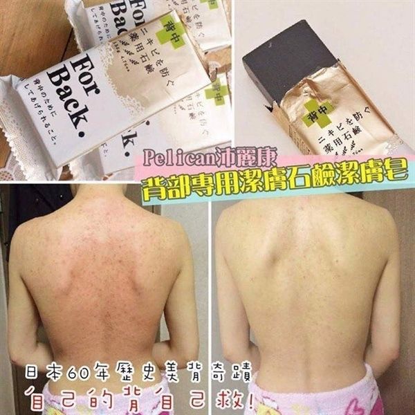 Xà Phòng Mụn Lưng Forback Nhật Bản 135g (04/2030)