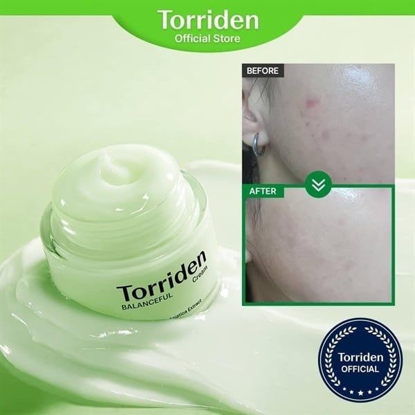 Kem Dưỡng Da Torriden Balanceful Cream 80ml