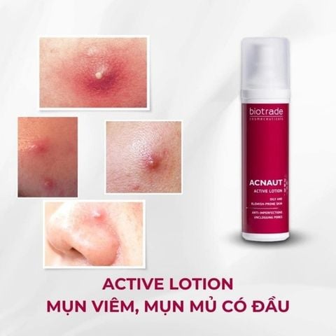 Lotion Trị Mụn Biotrade Acnaut Active 15ml (12/2029)
