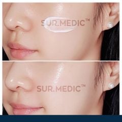 Kem Dưỡng Sur.Medic+ Hỗ Trợ Nâng Cơ, Cải Thiện Độ Đàn Hồi, Căng Mịn Super Peptide 100 Collagen Lifting Cream