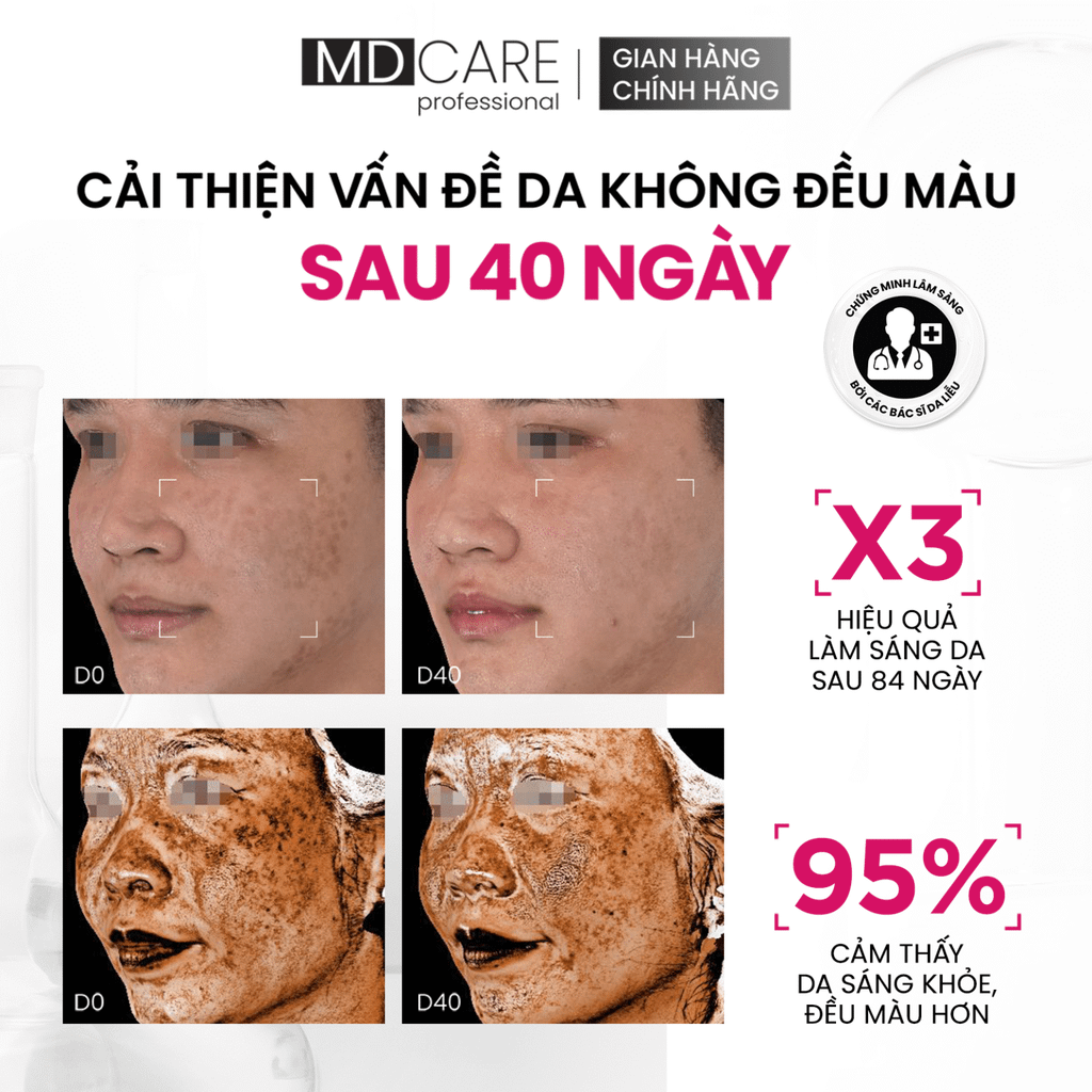 Serum Tinh Chất Làm Sáng Da Đa Tầng MDCARE Brightenyl Serum – Advanced Brightening Complex 30ml