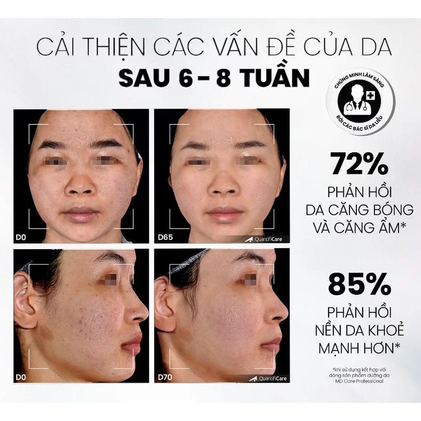Gel Rửa Mặt Sạch Sâu Và Tẩy Tế Bào Chết MD Care Mandelic Acid 5% Gel Cleanser