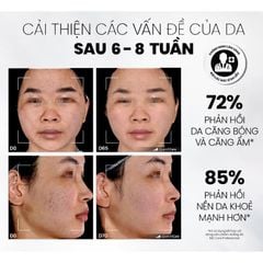 Gel Rửa Mặt Sạch Sâu Và Tẩy Tế Bào Chết MD Care Mandelic Acid 5% Gel Cleanser