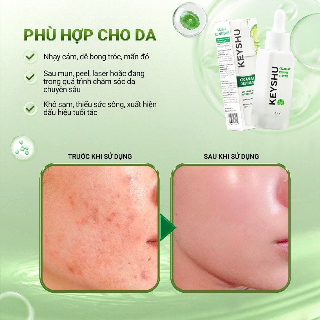 Tinh Chất Serum Keyshu Cicamax Refine Hỗ Trợ Làm Dịu Da – Hỗ Trợ Ngừa Lão Hóa 25ml