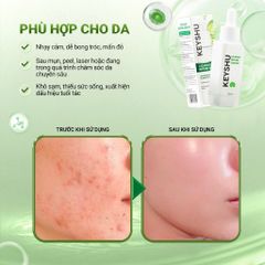 Tinh Chất Serum Keyshu Cicamax Refine Hỗ Trợ Làm Dịu Da – Hỗ Trợ Ngừa Lão Hóa 25ml