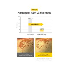 Serum Tinh Chất d'Alba Viên Nang Cải Thiện Nám Tàng Nhan Dưỡng Sáng Da 50ml