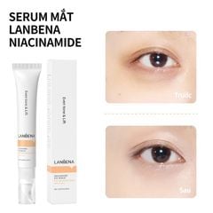 Kem Dưỡng Mắt LANBENA Niacinamide Làm Sáng Vùng Mắt 20ml