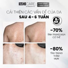 Xịt Tẩy Tế Bào Chết Toàn Thân MD CARE E.X.F.O Exfoliating Body Spray