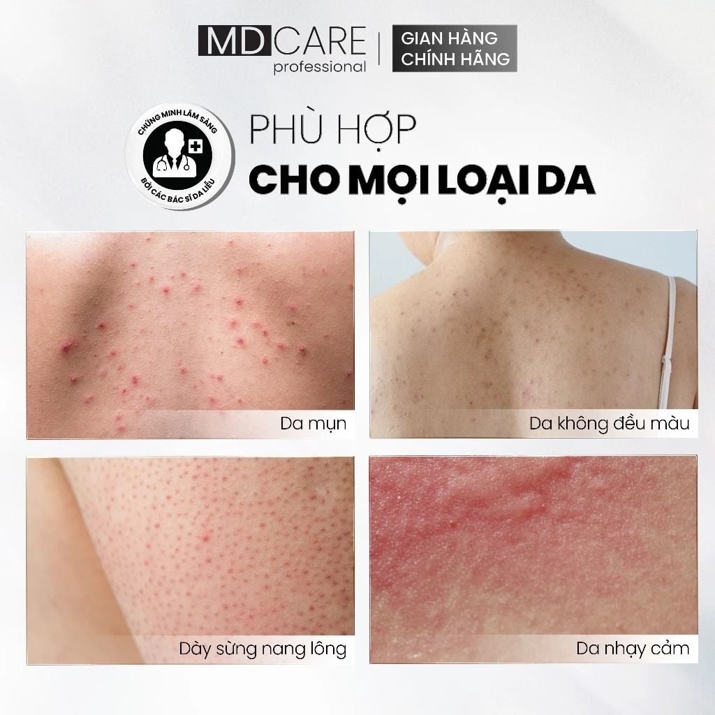 Xịt Tẩy Tế Bào Chết Toàn Thân MD CARE E.X.F.O Exfoliating Body Spray