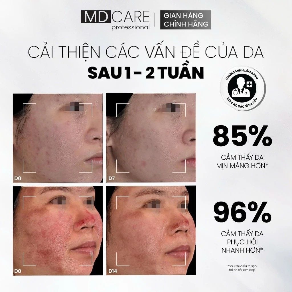 Tinh Chất Chống Lão Hóa, Tăng Sinh Collagen MD CARE Copper Peptide Serum 30ml
