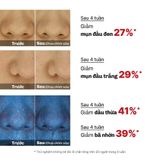  COSRX Tinh chất The AHA 2 BHA 2 Blemish Treatment Serum 50g 