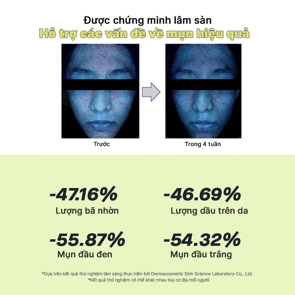  COSRX Kem Dưỡng Ẩm The Retinol 0.1 Cream 20ml 