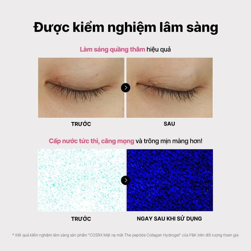  COSRX Mặt Nạ Mắt The Peptide Collagen Hydrogel Eye Patch 85g 