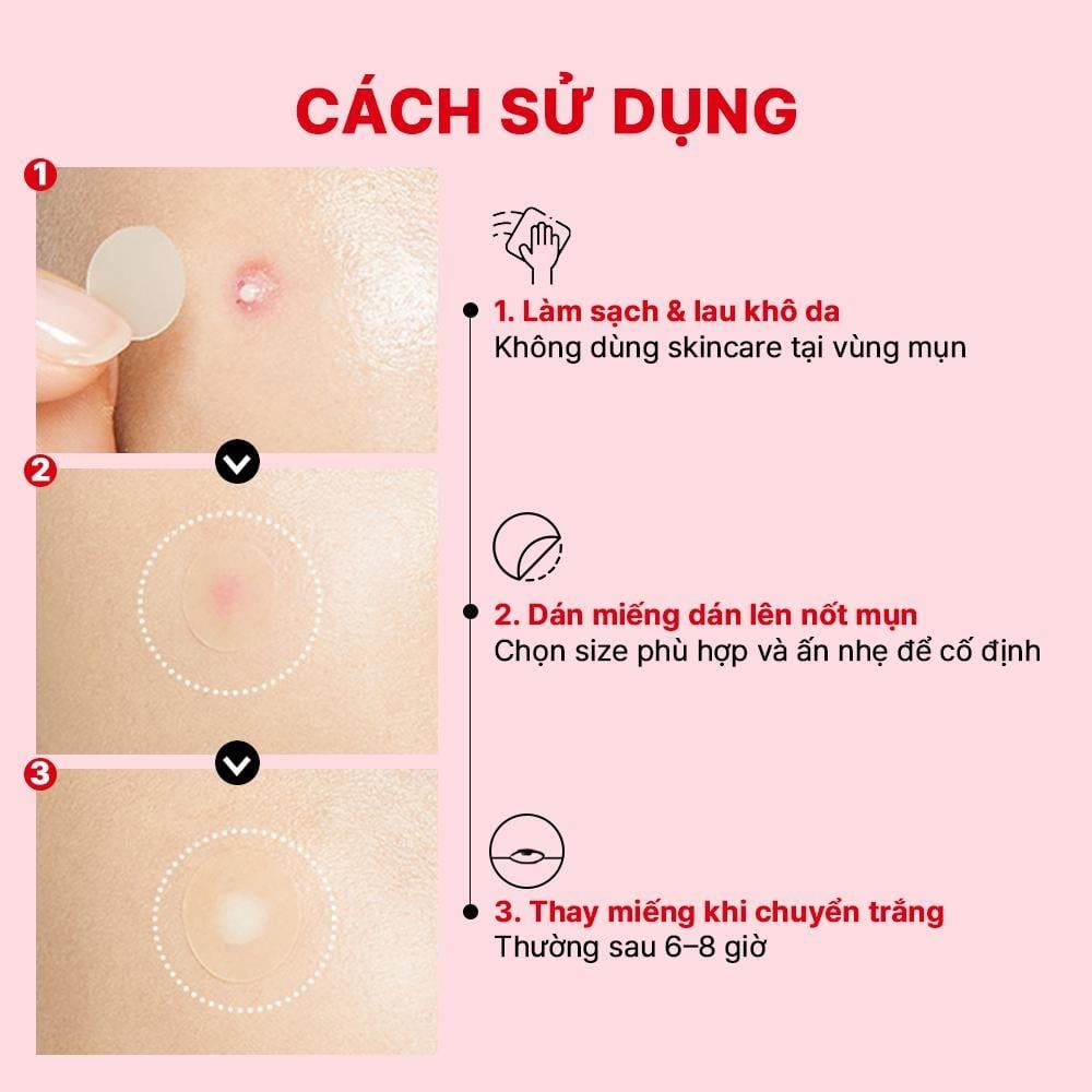  COSRX Miếng dán mụn (24 miếng) ANCE PIMPLE MASTER PATCH ORIGINAL FIT 