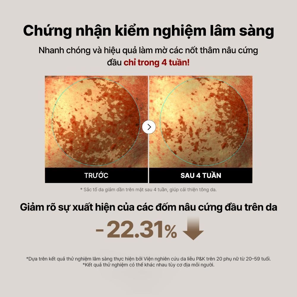  COSRX Tinh chất The Alpha-Arbutin 2 Discoloration Care Serum 50ml 