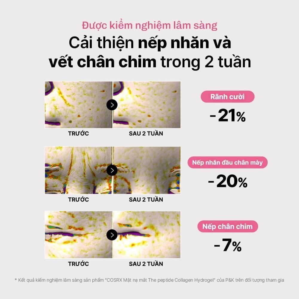  COSRX Mặt Nạ Mắt The Peptide Collagen Hydrogel Eye Patch 85g 