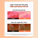  COSRX Toner phục hồi căng bóng 5 PDRN B5 VITAL SOOTHING TONER 280ml 