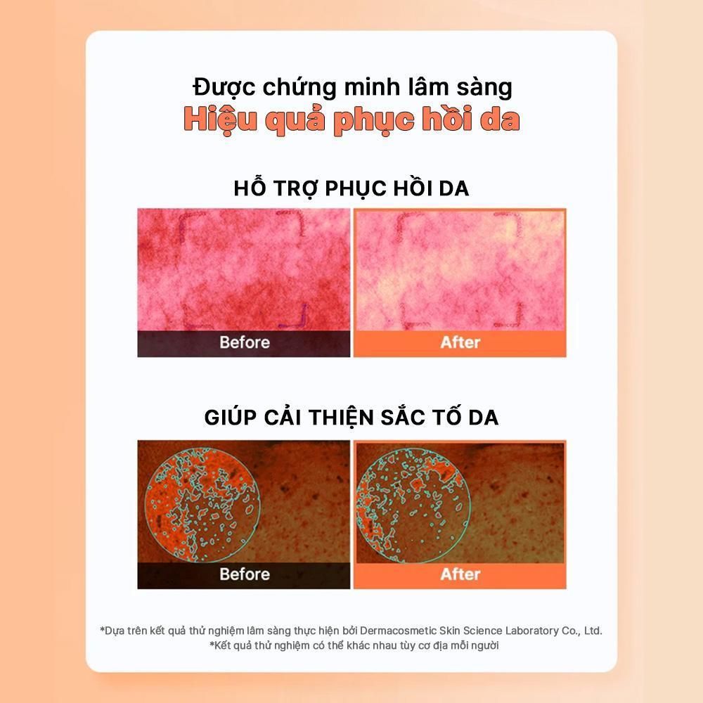  COSRX Toner phục hồi căng bóng 5 PDRN B5 VITAL SOOTHING TONER 280ml 