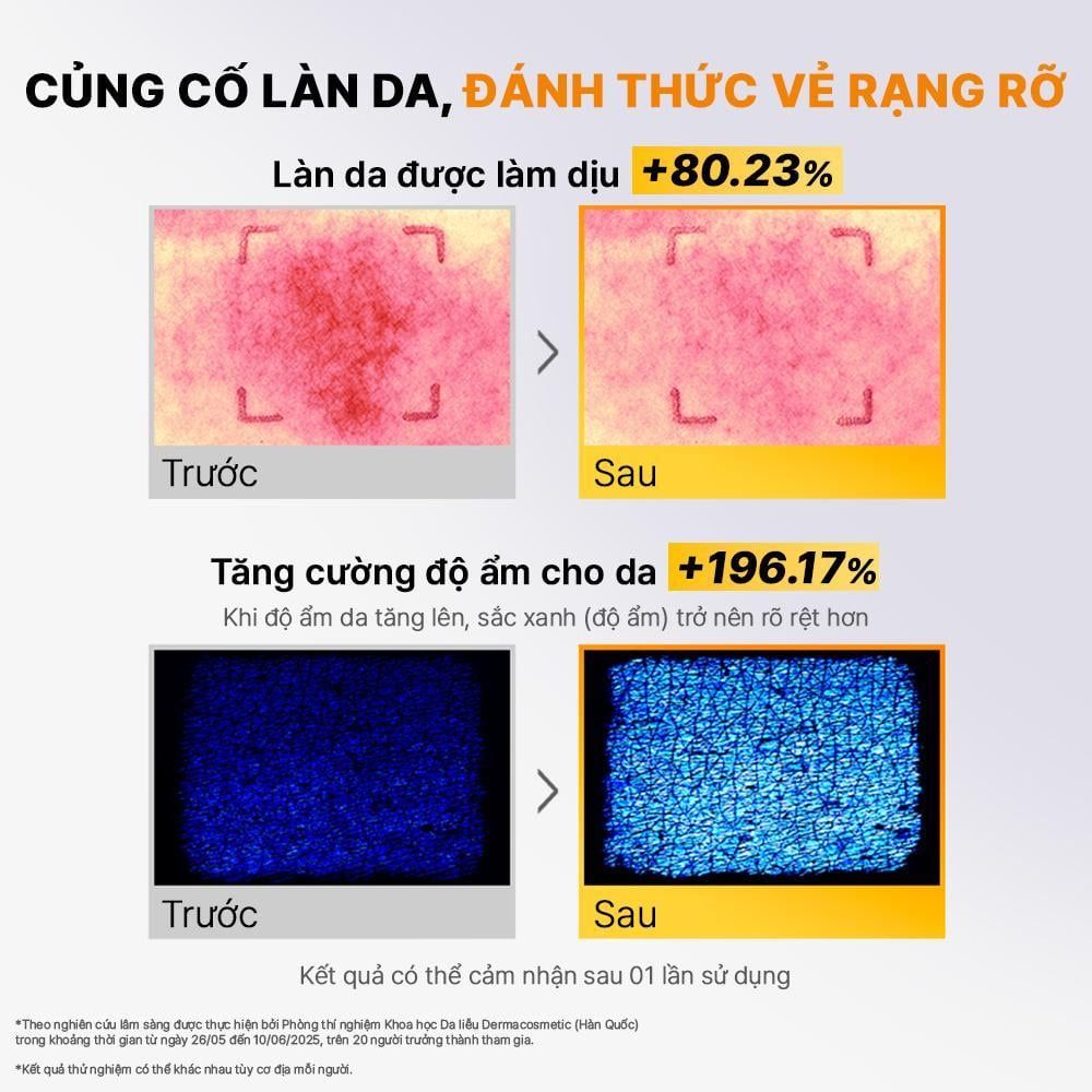  COSRX Tinh chất ốc sên dưỡng ẩm, phục hồi da Advanced Snail 96 Mucin Power Essence 100ml 
