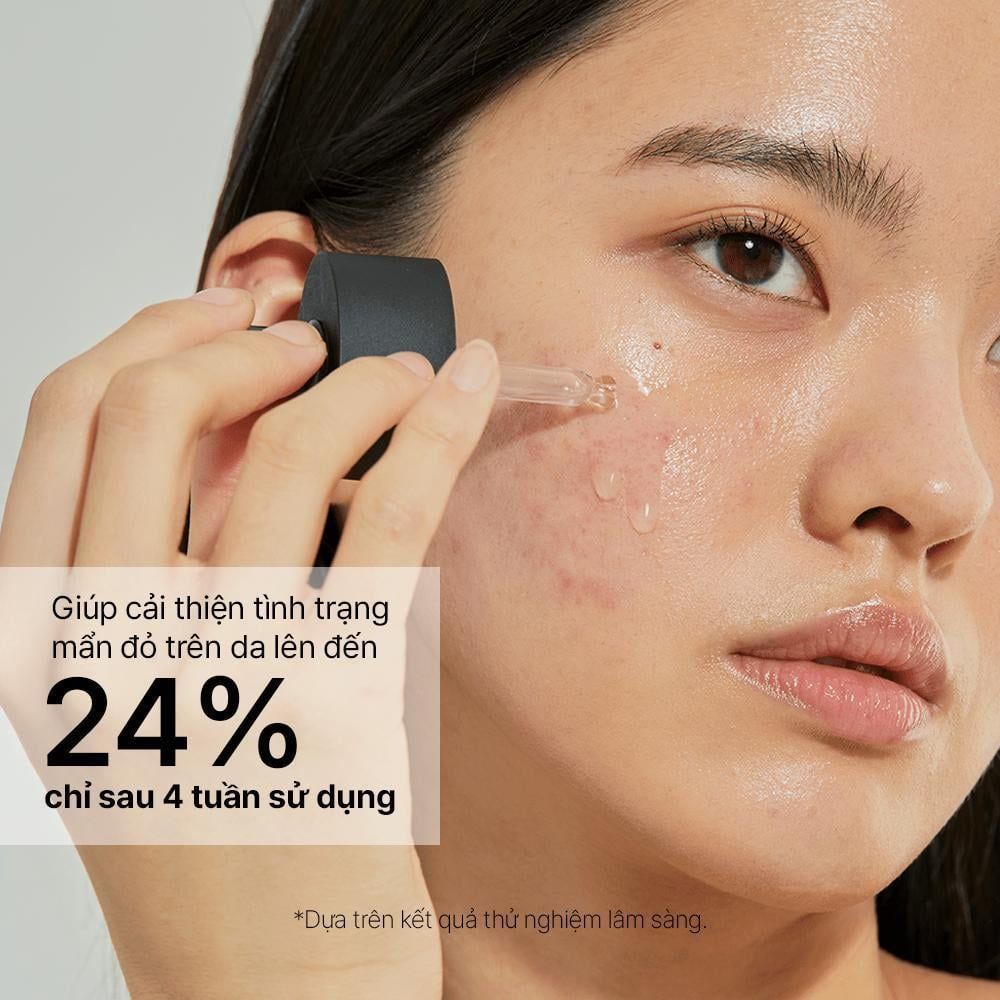  COSRX Tinh chất The Niacinamide 15 Serum 20mL 