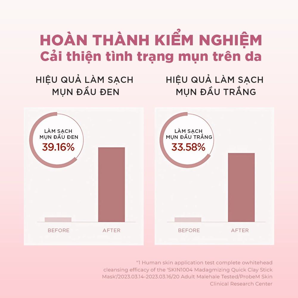  SKIN1004 Thanh lăn mặt nạ đất sét Madagascar Centella Poremizing Quick Clay Stick Mask 27g 